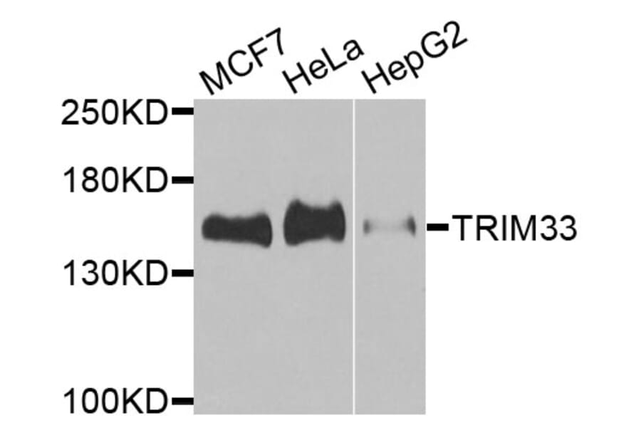 Western Blot - Anti-TRIM33 Antibody (A9919) - Antibodies.com