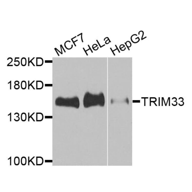 Western Blot - Anti-TRIM33 Antibody (A9919) - Antibodies.com