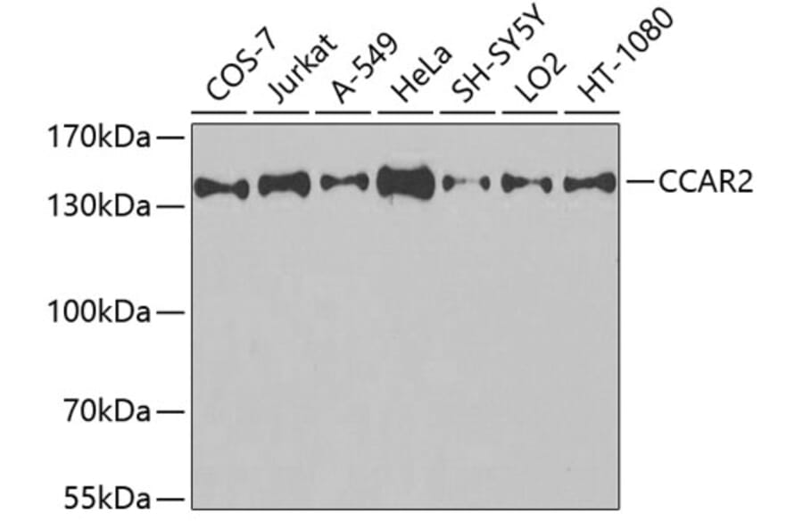 Western Blot - Anti-CCAR2 Antibody (A9920) - Antibodies.com