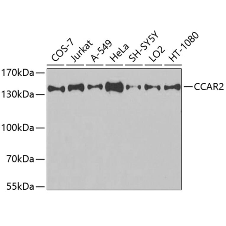 Western Blot - Anti-CCAR2 Antibody (A9920) - Antibodies.com