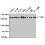 Western Blot - Anti-CCAR2 Antibody (A9920) - Antibodies.com