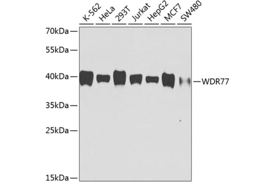 Western Blot - Anti-WDR77 Antibody [AMC0495] (A10843) - Antibodies.com