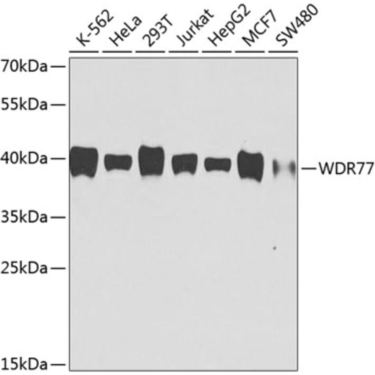 Western Blot - Anti-WDR77 Antibody [AMC0495] (A10843) - Antibodies.com