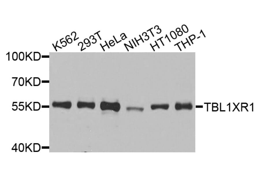 Western Blot - Anti-TBL1XR1 Antibody (A9922) - Antibodies.com