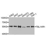 Western Blot - Anti-TBL1XR1 Antibody (A9922) - Antibodies.com