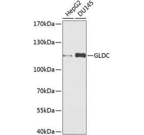 Western Blot - Anti-Glycine decarboxylase Antibody (A10845) - Antibodies.com