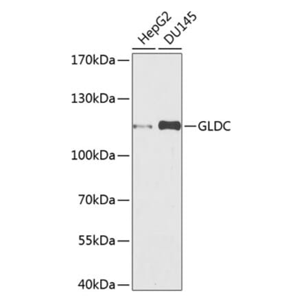 Western Blot - Anti-Glycine decarboxylase Antibody (A10845) - Antibodies.com