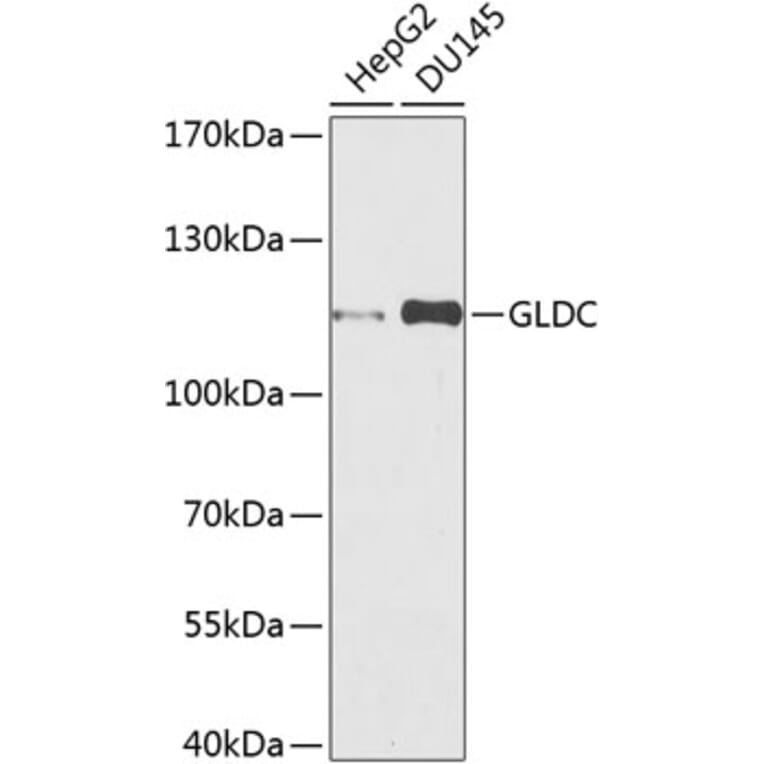 Western Blot - Anti-Glycine decarboxylase Antibody (A10845) - Antibodies.com