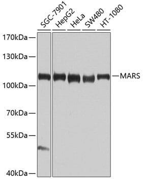 Western blot analysis of extracts of various cell lines, using Anti-MARS Antibody (A9938) at 1:1,000 dilution.
Secondary antibody: Goat Anti-Rabbit IgG (H+L) (HRP) (AS014) at 1:10,000 dilution.
Lysates / proteins: 25µg per lane.
Blocking buffer: 3% non-fat dry milk in TBST.
Detection: ECL Basic Kit (RM00020).
Exposure time: 30s.