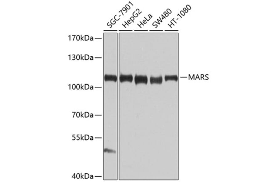 Western Blot - Anti-MetRS/MARS Antibody (A10846) - Antibodies.com
