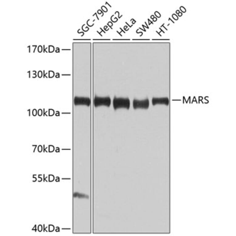 Western Blot - Anti-MetRS/MARS Antibody (A10846) - Antibodies.com