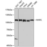 Western Blot - Anti-MetRS/MARS Antibody (A10846) - Antibodies.com