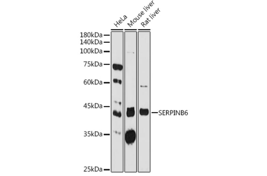 Western Blot - Anti-SerpinB6/CAP Antibody (A10847) - Antibodies.com