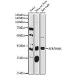 Western Blot - Anti-SerpinB6/CAP Antibody (A10847) - Antibodies.com