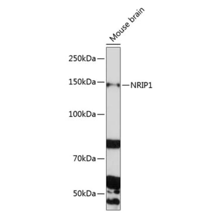 Western Blot - Anti-RIP140 Antibody (A10848) - Antibodies.com