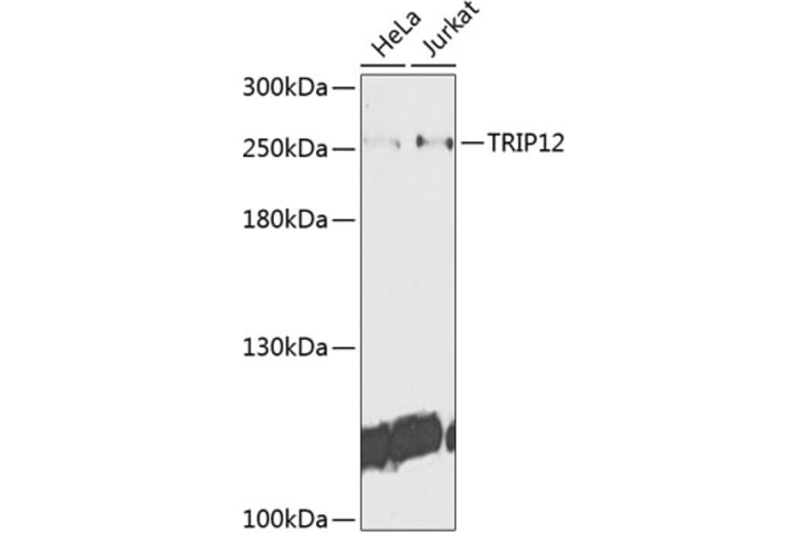 Western Blot - Anti-TRIP12/ULF Antibody (A10849) - Antibodies.com