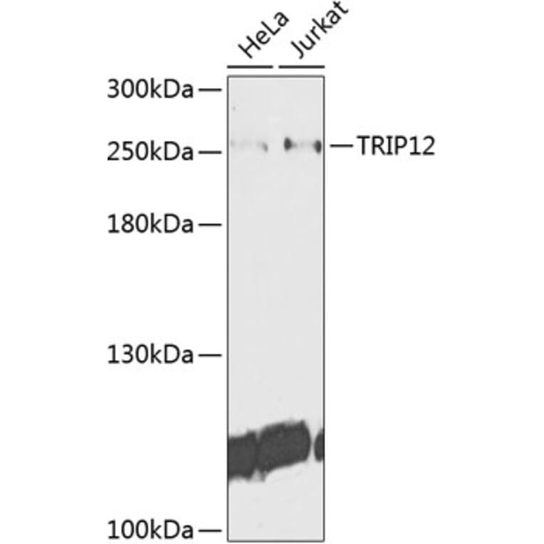 Western Blot - Anti-TRIP12/ULF Antibody (A10849) - Antibodies.com