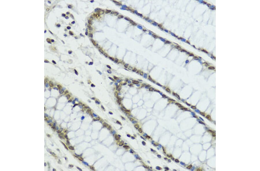 Immunohistochemistry - Anti-TRIP12/ULF Antibody (A10849) - Antibodies.com