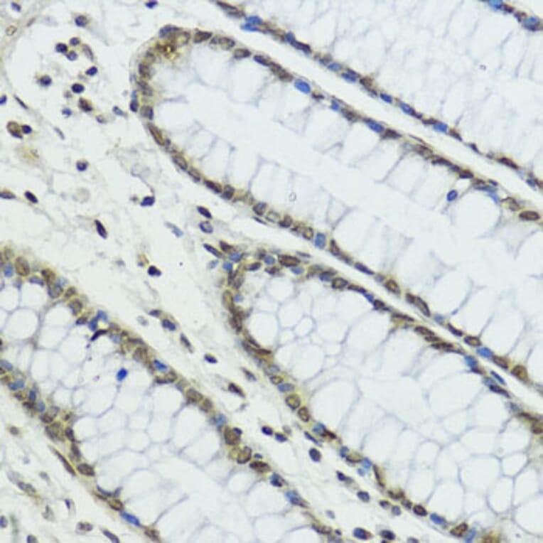Immunohistochemistry - Anti-TRIP12/ULF Antibody (A10849) - Antibodies.com