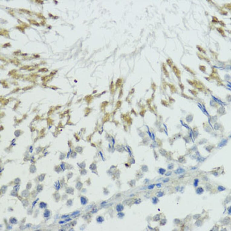 Immunohistochemistry - Anti-TRIP12/ULF Antibody (A10849) - Antibodies.com