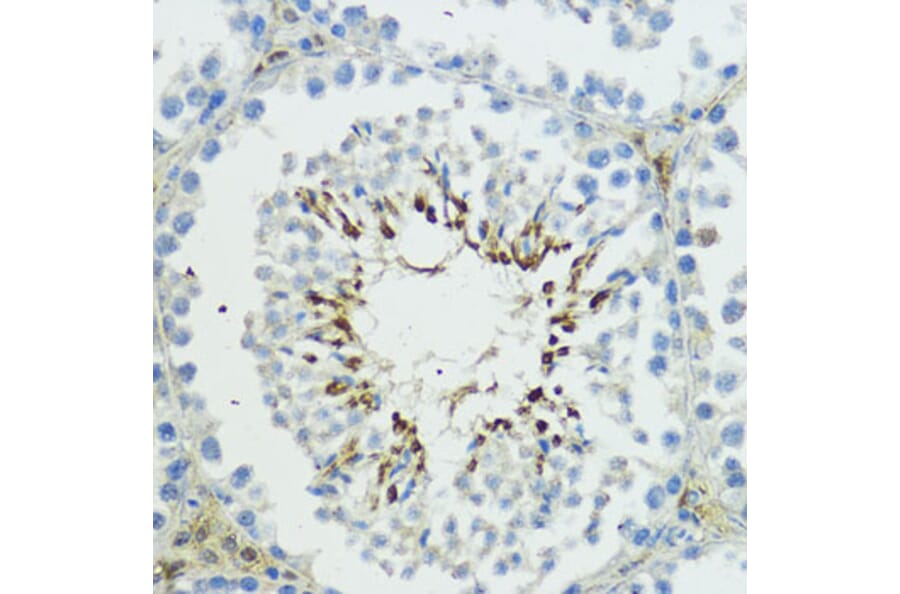 Immunohistochemistry - Anti-TRIP12/ULF Antibody (A10849) - Antibodies.com
