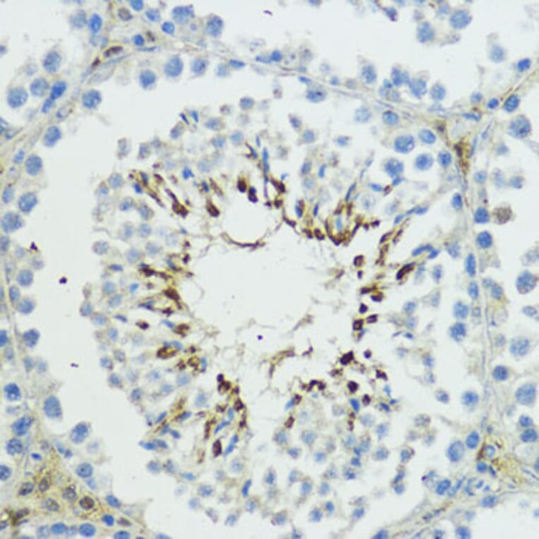 Immunohistochemistry - Anti-TRIP12/ULF Antibody (A10849) - Antibodies.com