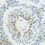 Immunohistochemistry - Anti-TRIP12/ULF Antibody (A10849) - Antibodies.com
