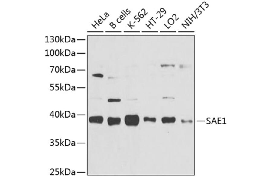 Western Blot - Anti-SAE1 Antibody (A10850) - Antibodies.com