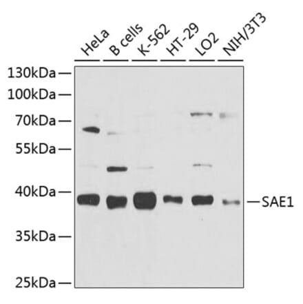 Western Blot - Anti-SAE1 Antibody (A10850) - Antibodies.com