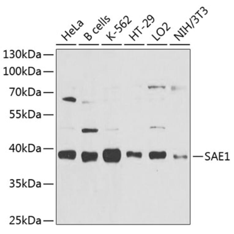 Western Blot - Anti-SAE1 Antibody (A10850) - Antibodies.com