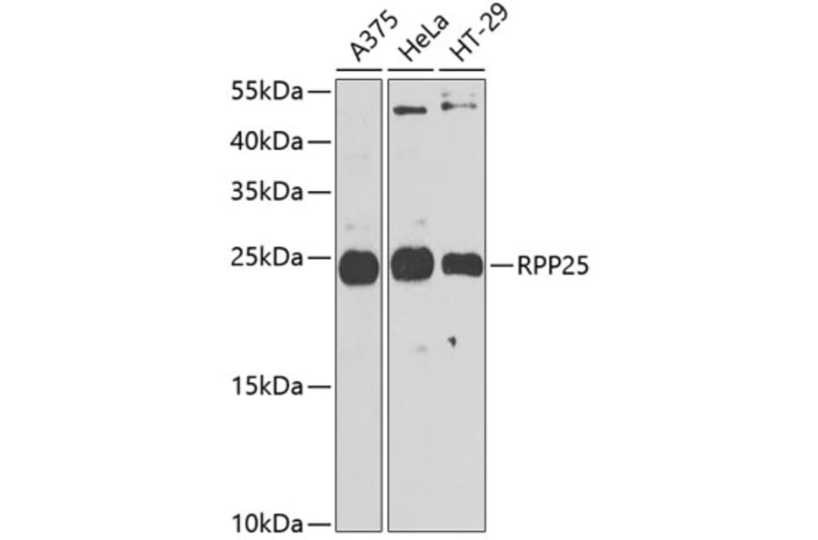 Western Blot - Anti-RPP25 Antibody (A10851) - Antibodies.com