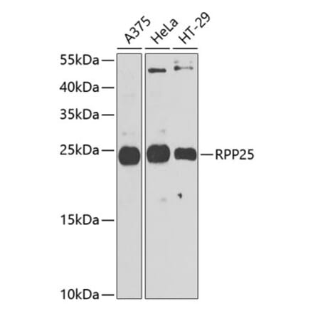 Western Blot - Anti-RPP25 Antibody (A10851) - Antibodies.com