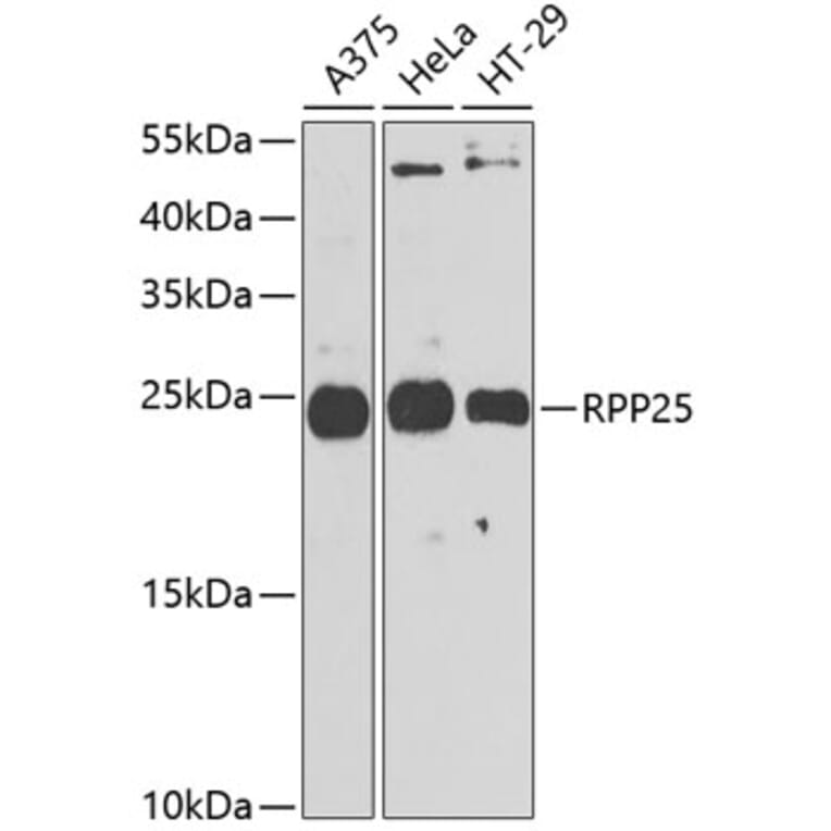 Western Blot - Anti-RPP25 Antibody (A10851) - Antibodies.com