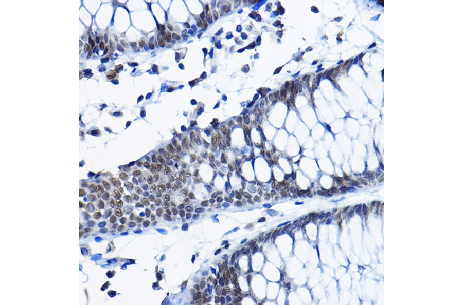 Immunohistochemistry - Anti-RPP25 Antibody (A10851) - Antibodies.com