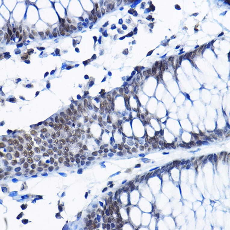 Immunohistochemistry - Anti-RPP25 Antibody (A10851) - Antibodies.com