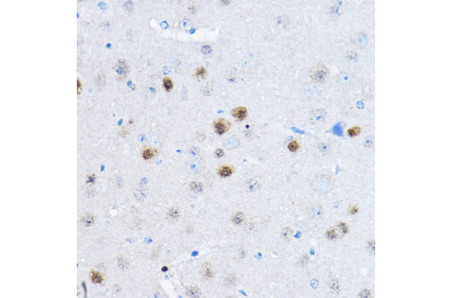 Immunohistochemistry - Anti-RPP25 Antibody (A10851) - Antibodies.com