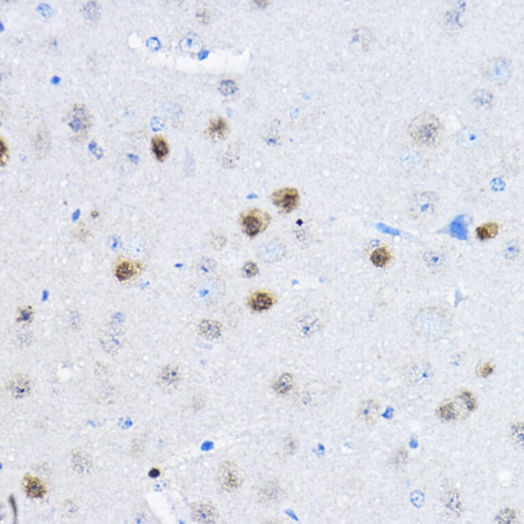 Immunohistochemistry - Anti-RPP25 Antibody (A10851) - Antibodies.com