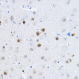 Immunohistochemistry - Anti-RPP25 Antibody (A10851) - Antibodies.com