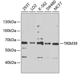 Western Blot - Anti-RNF23 Antibody (A10852) - Antibodies.com