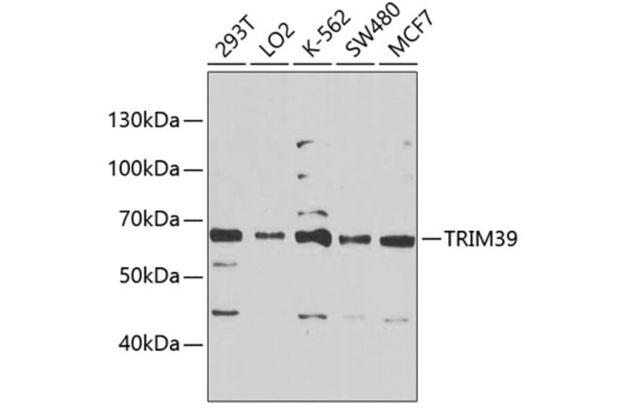 Western Blot - Anti-RNF23 Antibody (A10852) - Antibodies.com