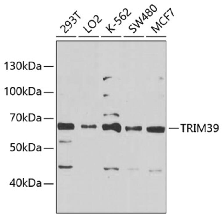 Western Blot - Anti-RNF23 Antibody (A10852) - Antibodies.com