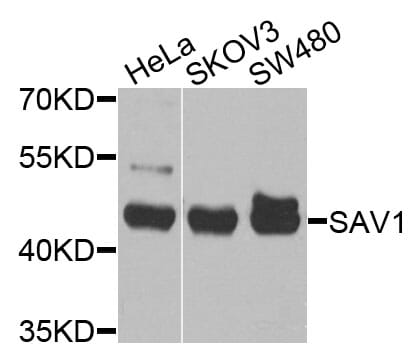 Western blot analysis of extracts of various cell lines, using Anti-SAV1 Antibody (A9980) at 1:1,000 dilution.
Secondary antibody: Goat Anti-Rabbit IgG (H+L) (HRP) (AS014) at 1:10,000 dilution.
Lysates / proteins: 25µg per lane.
Blocking buffer: 3% non-fat dry milk in TBST.
Detection: ECL Basic Kit (RM00020).
Exposure time: 30s.