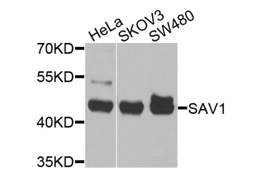 Western Blot - Anti-SAV1 Antibody (A10854) - Antibodies.com