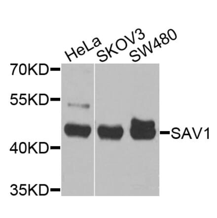 Western Blot - Anti-SAV1 Antibody (A10854) - Antibodies.com