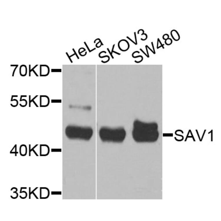 Western Blot - Anti-SAV1 Antibody (A10854) - Antibodies.com