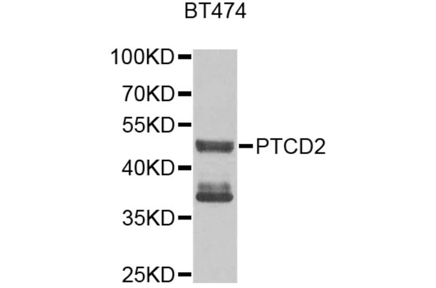Western Blot - Anti-PTCD2 Antibody (A9982) - Antibodies.com