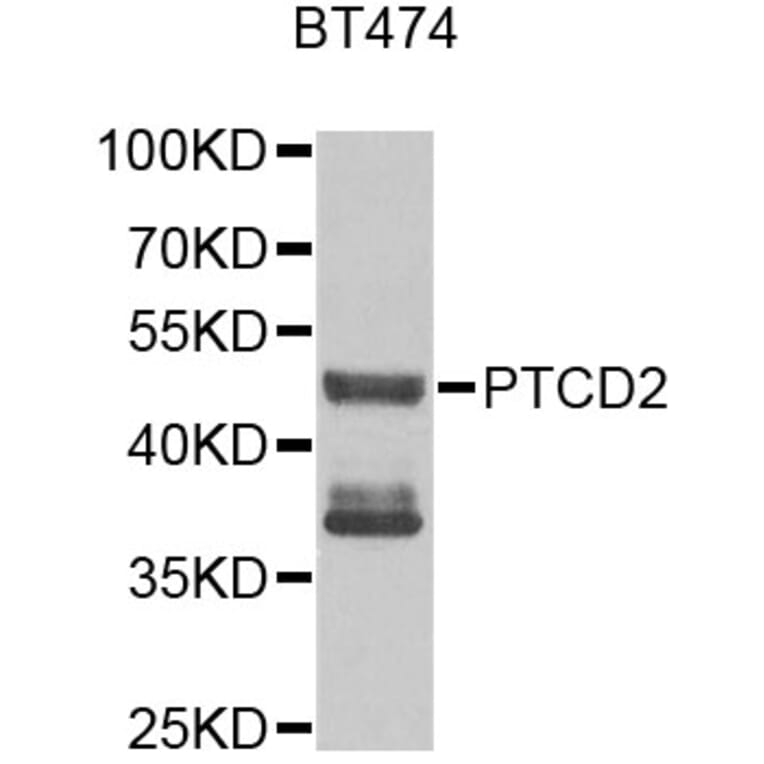 Western Blot - Anti-PTCD2 Antibody (A9982) - Antibodies.com