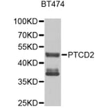 Western Blot - Anti-PTCD2 Antibody (A9982) - Antibodies.com