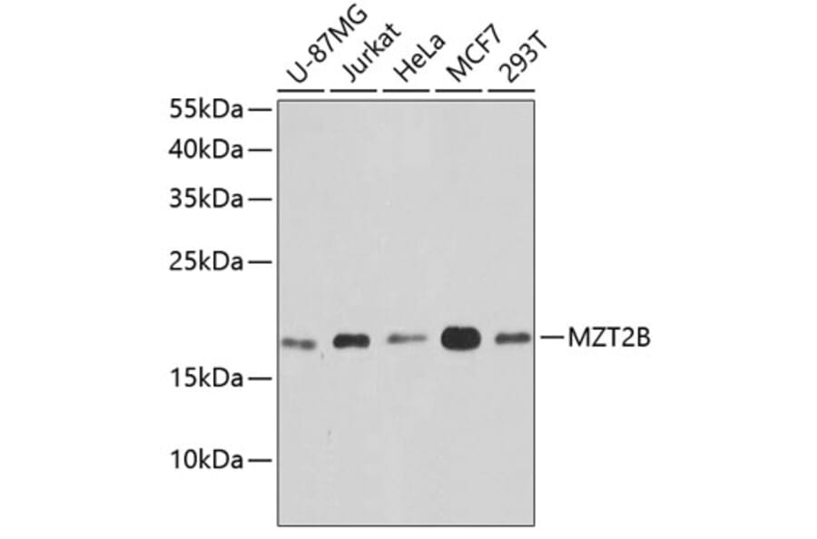 Western Blot - Anti-MZT2B Antibody (A10856) - Antibodies.com