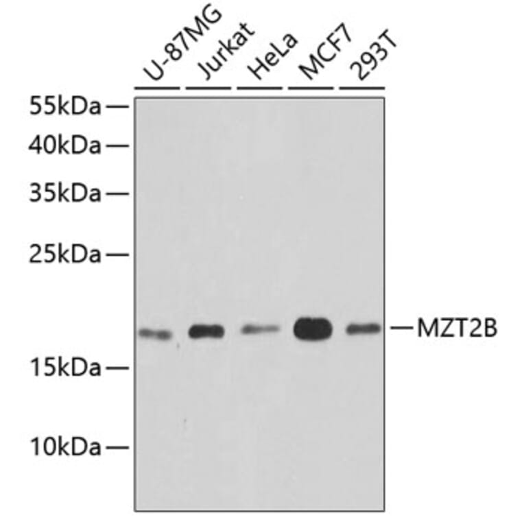 Western Blot - Anti-MZT2B Antibody (A10856) - Antibodies.com